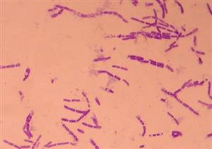 炭疽杆菌1