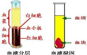 血液分层
