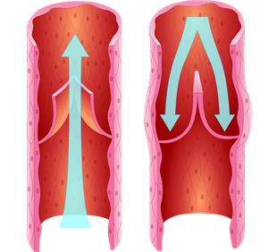 静脉瓣活动示意图