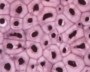 柿胚乳细胞