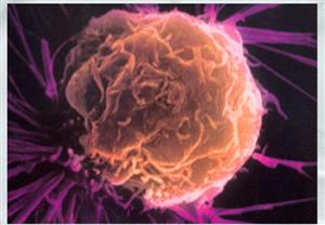 癌细胞3