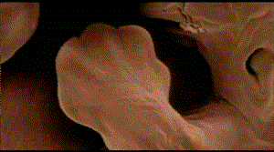 胎儿手形的发育