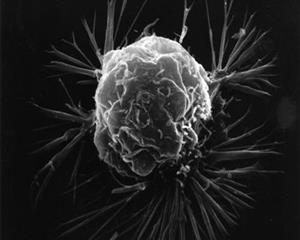 乳腺癌细胞1
