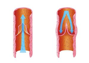 静脉瓣活动示意图
